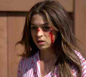 A woman with a bloody face injury, looking distressed and outdoors.