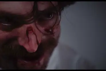 Close-up of a man with bloodied face and intense expression, horror scene from Dracula review.